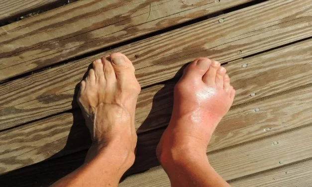 Retención de agua: ¿Qué puedes hacer?